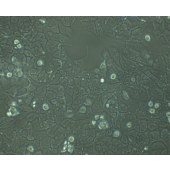 TSINGKE TC‒H0008 MHCC97-L 人低转移潜能肝癌细胞