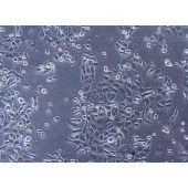 TSINGKE TC‒H0088 JIMT-1 人乳腺癌细胞