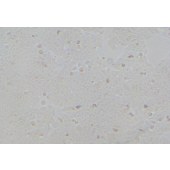 TSINGKE TC‒H0084 MDA-MB-361 人乳腺癌细胞
