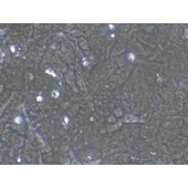 TSINGKE TC‒H0107 HCT-15 人结直肠腺癌上皮细胞