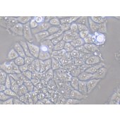 TSINGKE TC‒H0068 T47D 人乳腺导管癌细胞