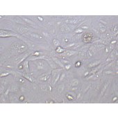 TSINGKE TC‒H0184 ACHN 人肾细胞腺癌细胞