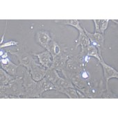 TSINGKE TC‒R0018 4T1 小鼠乳腺癌细胞