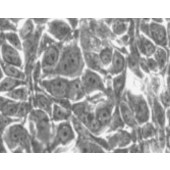 TSINGKE TC‒H0081 BT-20 人乳腺癌细胞