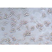 TSINGKE TC‒H0195 Namalwa 人Burkitt's淋巴瘤细胞