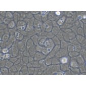 TSINGKE TC‒H0153 SW780 人膀胱移行细胞癌细胞