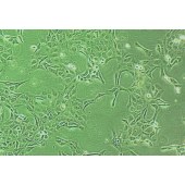 TSINGKE TC‒H0305 HCE-T 人角膜上皮细胞