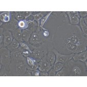 TSINGKE TC‒H0132 FaDu 人咽鳞癌细胞