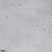 TSINGKE TC‒H0011 SNU-387 人多形性肝癌细胞