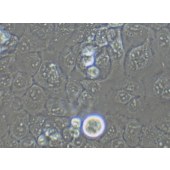 TSINGKE TC‒H0127 Kyse-150 人食管鳞癌细胞