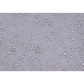 TSINGKE TC‒H0226 Jurkat E6-1 人急性T淋巴细胞白血病细胞