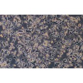 TSINGKE TC‒H0286 AsPC-1 人转移胰腺腺癌细胞(中等至未分化)