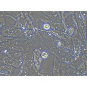 TSINGKE TC‒H0152 UM-UC-3 人膀胱移行细胞癌细胞