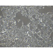 TSINGKE TC‒H0055 NCI-H3122 人肺腺癌细胞