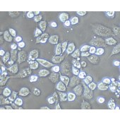 TSINGKE TC‒H0006 SNU-398 人肝癌细胞