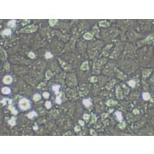 TSINGKE TC‒H0037 NCI-H23 人非小细胞肺癌细胞