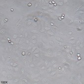 TSINGKE TC‒H0012 SNU-182 人肝癌细胞