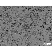 TSINGKE TC‒H0201 Su-DHL-6 人B细胞淋巴瘤细胞