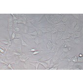 TSINGKE TC‒H0279 KHM-5M 人甲状腺癌细胞（退行性）
