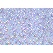 TSINGKE TC‒H0233 CCRF-CEM 人急性淋巴细胞白血病T淋巴细胞