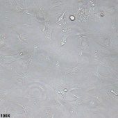 TSINGKE TC‒H0014 SNU-423 人肝癌细胞