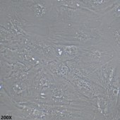 TSINGKE TC‒H0011 SNU-387 人多形性肝癌细胞