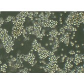 TSINGKE TC‒X0011 B95-8 EBV转化棉顶狨淋巴细胞