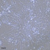 TSINGKE TC‒H0003 Hep3B 人肝癌细胞