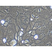 TSINGKE TC‒H0141 NIH/OVCAR-3 人卵巢腺癌细胞