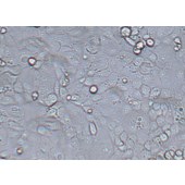 TSINGKE TC‒H0141 NIH/OVCAR-3 人卵巢腺癌细胞
