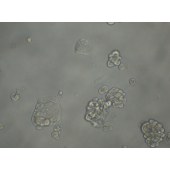 TSINGKE TC‒H0086 UACC812 人乳腺原导管瘤细胞