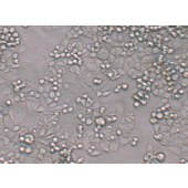 TSINGKE TC‒H0163 C-33A 人宫颈癌细胞