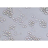 TSINGKE TC‒H0220 SK-MEL-1 人皮肤黑色素瘤细胞