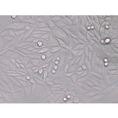 TSINGKE TC‒H0160 SiHa 人子宫颈鳞状细胞癌细胞