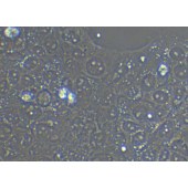 TSINGKE TC‒H0147 JEG-3 人绒毛膜癌细胞