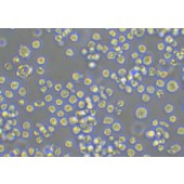 TSINGKE TC‒H0193 Daudi 人Burkkit淋巴瘤细胞