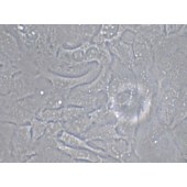 TSINGKE TC‒H0140 SK-OV-3 人卵巢腺癌细胞