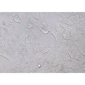 TSINGKE TC‒H0277 BHT-101 人甲状腺癌细胞（退行性）