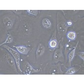 TSINGKE TC‒H0187 Caki-2 人乳头状肾细胞癌细胞