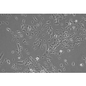 TSINGKE TC‒H0267 SK-N-SH 人神经母细胞瘤细胞