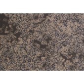 TSINGKE TC‒H0100 RKO 人结肠癌细胞