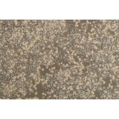 TSINGKE TC‒H0164 RL95-2 人子宫内膜癌细胞