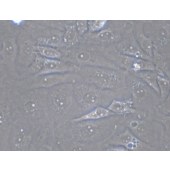 TSINGKE TC‒H0070 MDA-MB-157 人乳腺癌细胞