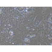 TSINGKE TC‒H0049 NCI-H2170 人肺鳞癌细胞