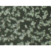 TSINGKE TC‒H0073 MDA-MB-453 人乳腺癌细胞