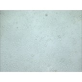 TSINGKE TC‒H0022 NCI-H1299 人非小细胞肺癌细胞