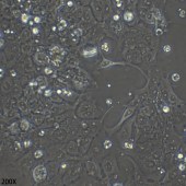 TSINGKE TC‒H0026 NCI-H1573 人非小细胞肺腺癌细胞