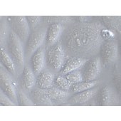 TSINGKE TC‒H0051 SK-Lu-1 人低分化肺腺癌细胞