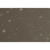 TSINGKE TC‒H0254 SW1353 人骨肉瘤细胞