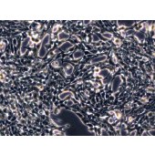 TSINGKE TC‒H0281 TT 人甲状腺导管癌细胞（髓样癌）